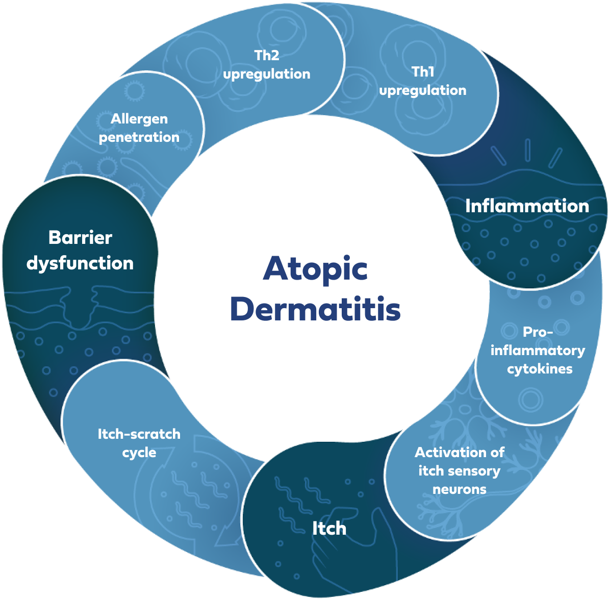 Graphic depicting the vicious cycle of atopic dermatitis, with key steps of barrier dysfunction, inflammation and itch.